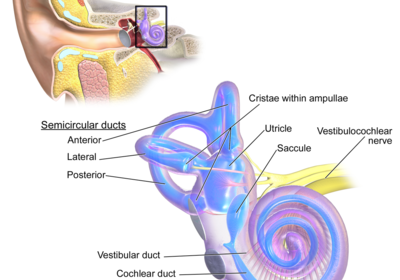 Vertigo Causes in Young Adults